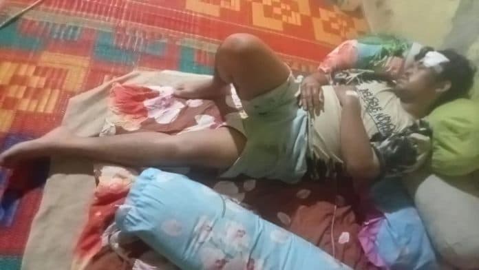 mahasiswa_yang_jatuh_mengejar_maling_motor_dibawa_pulang_dari_rumah_sakit