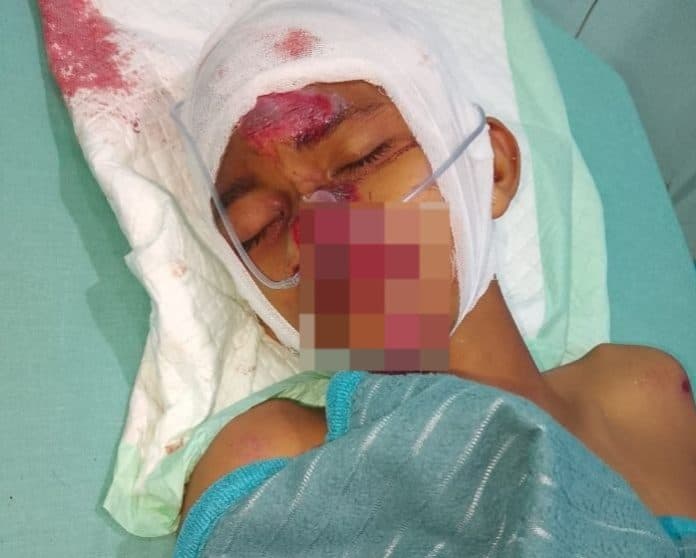 pelajar_dibacok_di_deli_serdang_polisi_kantongi_identitas_pelaku_yang_diduga_geng_motor