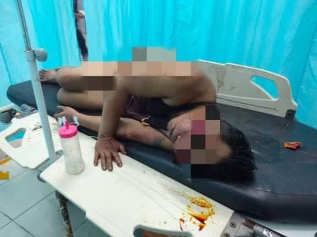 pelaku_begal_siswi_sma_di_asahan_sekarat_dihajar_massa