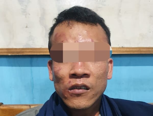 pelaku_pencurian_emas_senilai_rp120_juta_di_tebing_tinggi_diciduk_polisi