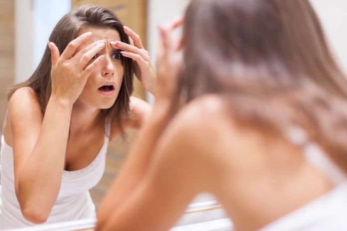 penggunaan_concealer_bisa_timbulkan_jerawat_baru