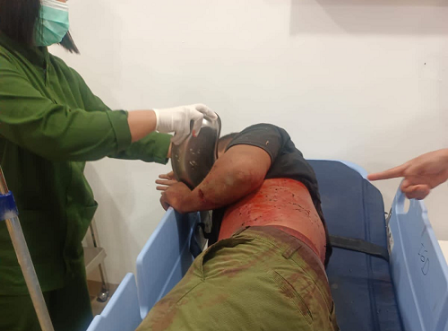 polisi_buru_pelaku_penikaman_sopir_di_kedai_tuak_tanjung_pinggir