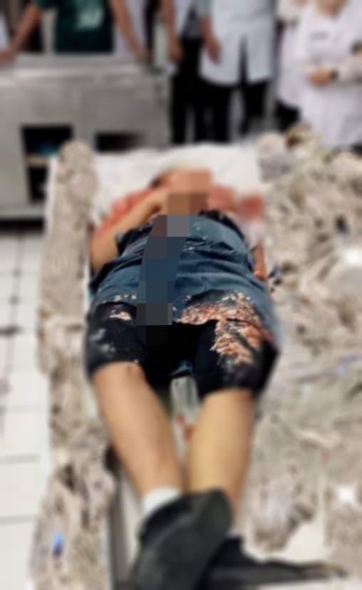 polisi_masih_selidiki_kasus_pelajar_sma_yang_tewas_terlindas_truk_di_percut_sei_tuan