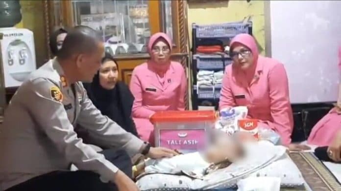 polres_asahan_galakkan_program_jemari_sipope_anak_penderita_hidrosefalus_dibantu