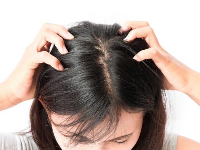 rambut_anda_berketombe_ini_obat_alami_untuk_mengatasinya