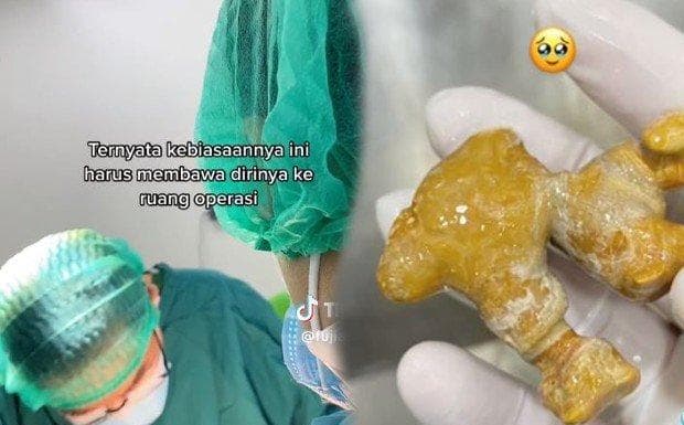 sakit_pinggang_2_tahun_wanita_ini_alami_batu_ginjal_karena_jarang_minum_air
