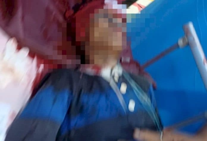 satu_orang_kritis_akibat_bentrok_di_belawan_diduga_tertembak_petugas