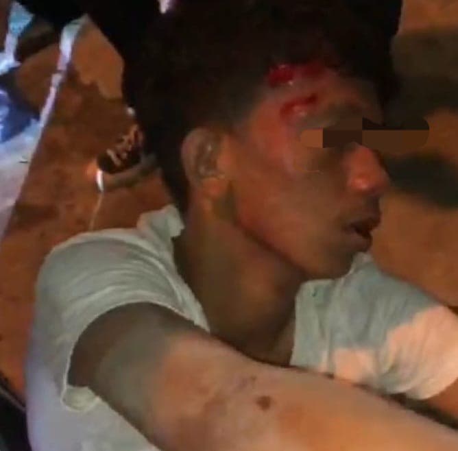 sempat_viral_di_medsos_kasus_terduga_begal_masih_ditangani_polres_tebing_tinggi