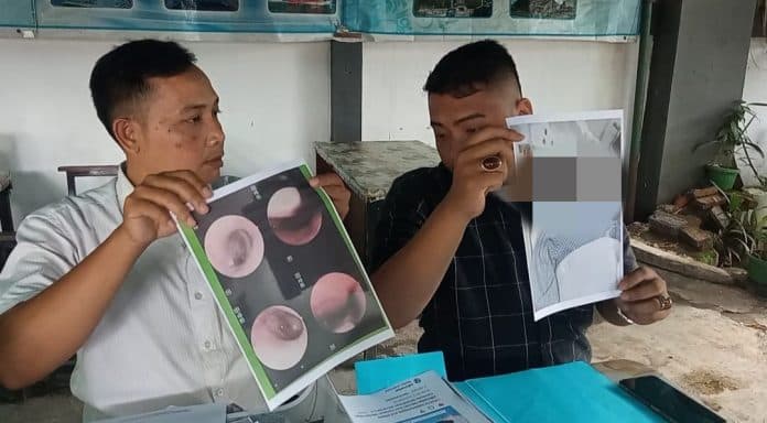 siswa_kelas_1_di_medan_diduga_jadi_korban_perundungan_kakak_kelas