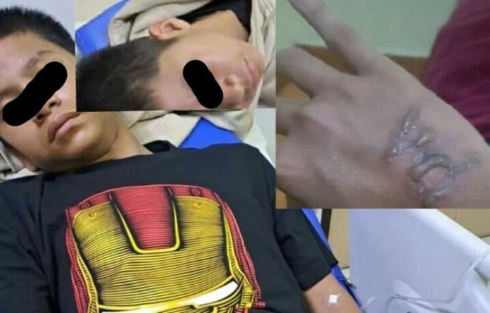 siswa_man_1_medan_diduga_jadi_korban_bullying_seniornya