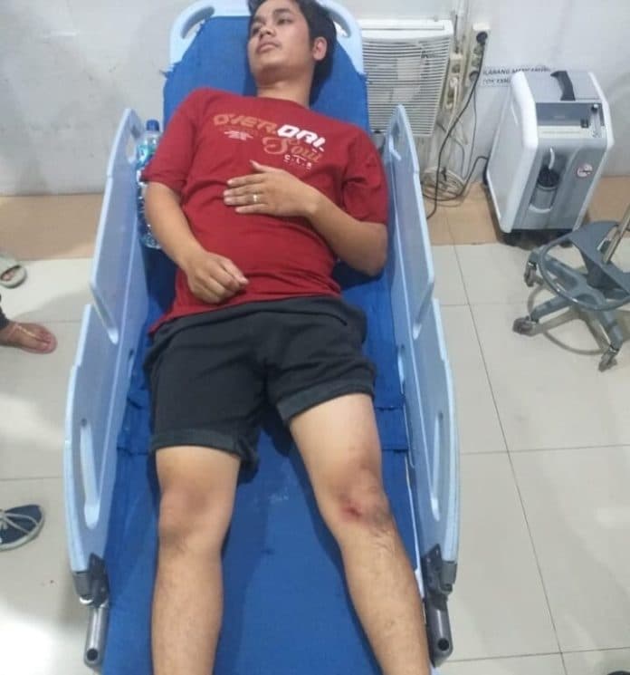tabrak_dua_orang_pemotor_di_flyover_jamin_ginting_sopir_mobil_honda_crv_ditetapkan_tersangka