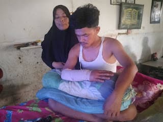tangan_pemuda_belawan_nyaris_putus_usai_dibacok_otk