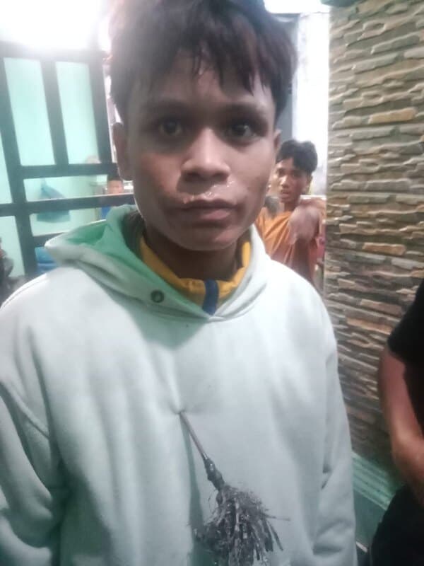 tawuran_di_belawan_pecah_sejumlah_anak_muda_kena_panah