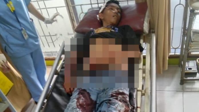 tawuran_di_sunggal_ditenggarai_geng_motor_ini_identitas_korban
