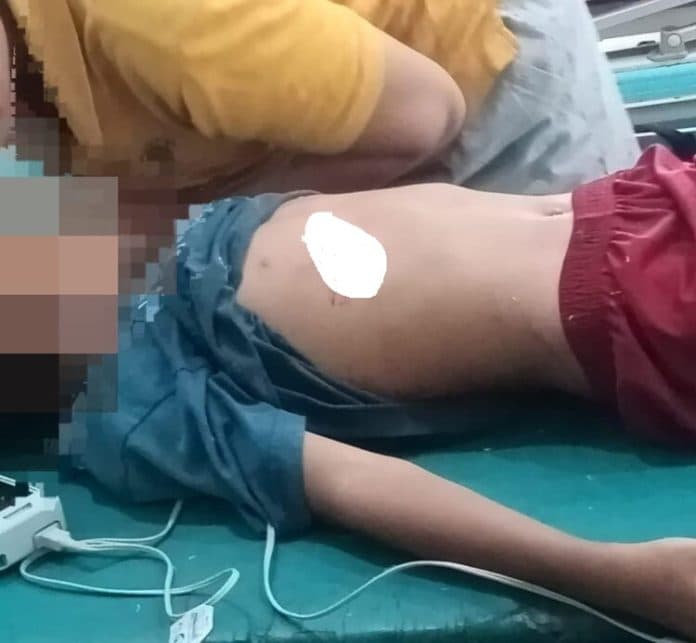 tawuran_pecah_di_belawan_saat_banjir_rob_anak_kecil_korban_dipanah