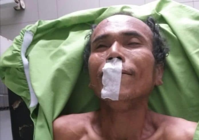 tepergok_rudapaksa_putri_tiri_ayah_tenggak_racun_lalu_tewas_di_percut_sei_tuan