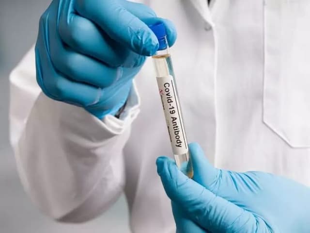 tes_antibodi_covid_19_perlukah_anda_melakukannya