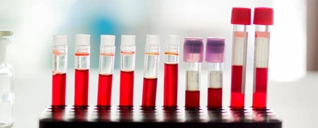 tes_darah_terbaru_bisa_mendeteksi_5_jenis_kanker_sebelum_didiagnosis