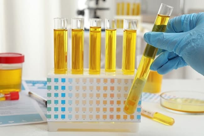 waspada_ginjal_akut_orang_tua_diminta_cek_volume_urine_anak
