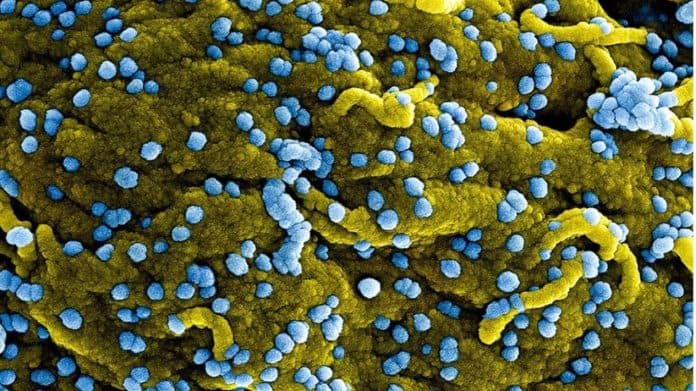 waspada_virus_marburg_spanyol_umumkan_kasus_suspek_pertama