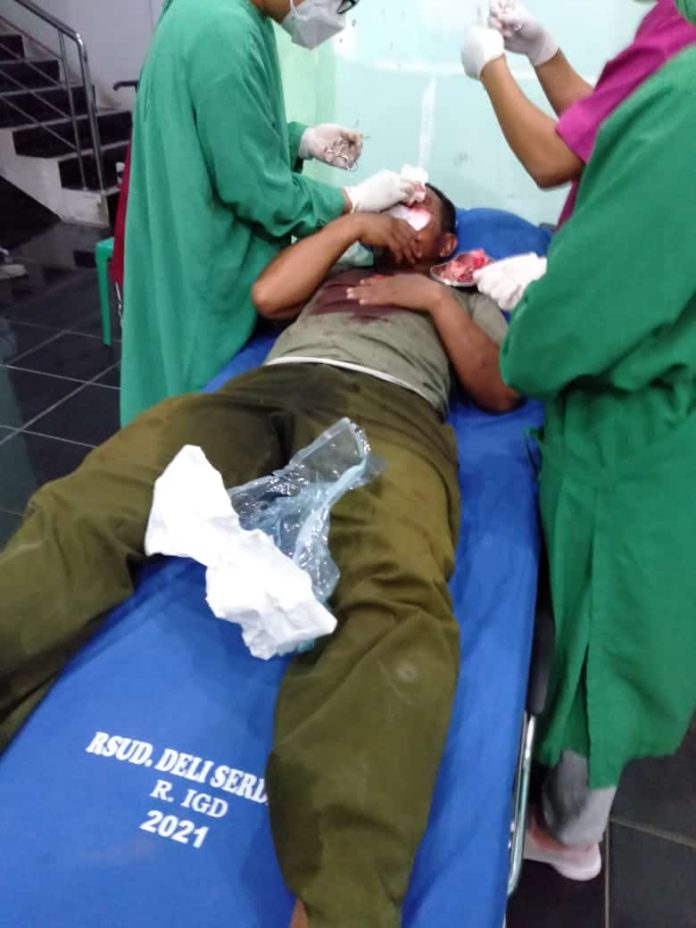 Serda Mulyaman saat diobati luka di jidatnya oleh petugas RSUD Deli Serdang. (f:mistar/ist)