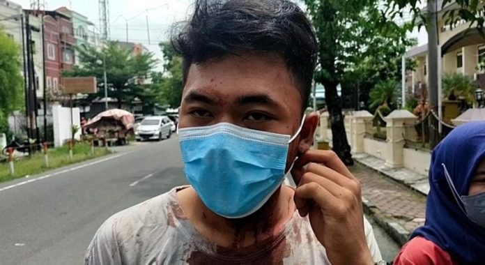 Kondisi Berlumuran Darah, Mahasiswa Ini Ngadu ke Polrestabes Medan