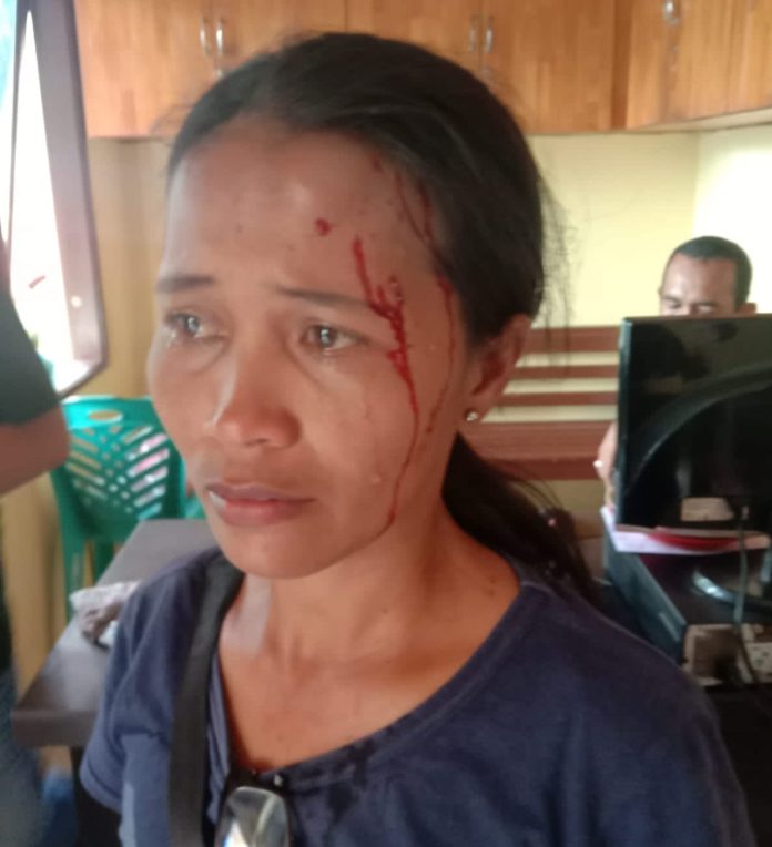 Dipukul dengan Gelas Hingga Berdarah, IRT di Siantar Lapor Polisi