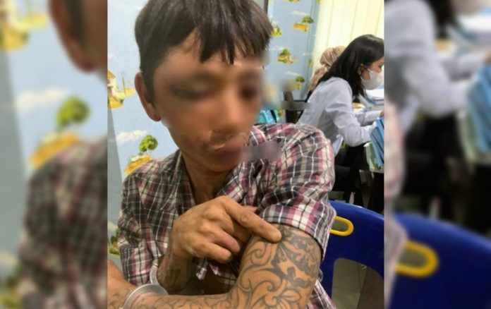 Mantan Napi Dihakim Warga Akibat Cabuli Bocah 10 Tahun di Medan