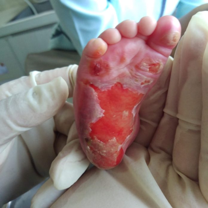 Miris! Bayi Baru Lahir Ini Diduga Jadi Malapraktik di RS Mitra Medika Amplas