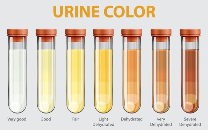 Ilustrasi warna urin menunjukkan kesehatan seseorang (f:ist/mistar)